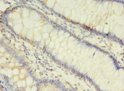 ALOX5 Antibody