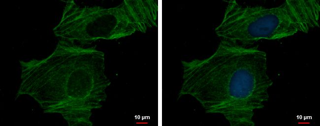 alpha Cardiac Muscle Actin Rabbit Polyclonal Antibody