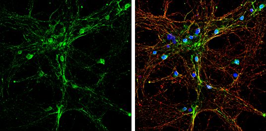 alpha SNAP Rabbit Polyclonal Antibody