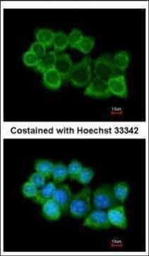 alpha SNAP Rabbit Polyclonal Antibody
