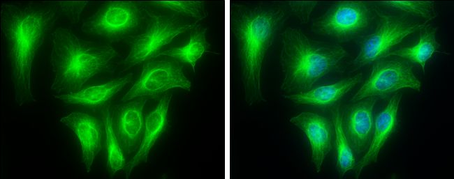 alpha Tubulin 1A Rabbit Polyclonal Antibody