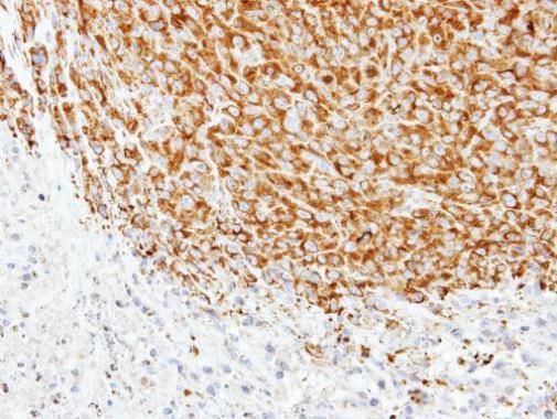 alpha Tubulin 1A Rabbit Polyclonal Antibody