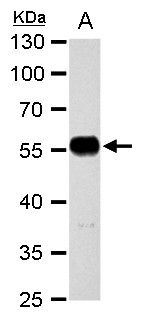 alpha Tubulin 1A Rabbit Polyclonal Antibody