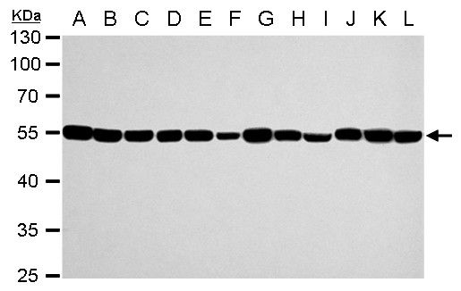 alpha Tubulin 1A Rabbit Polyclonal Antibody