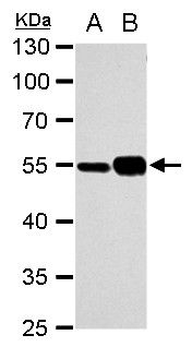 alpha Tubulin 1A Rabbit Polyclonal Antibody