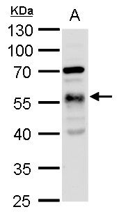 alpha Tubulin 1A Rabbit Polyclonal Antibody