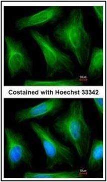 alpha Tubulin 1A Rabbit Polyclonal Antibody