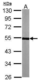 alpha Tubulin 1A Rabbit Polyclonal Antibody