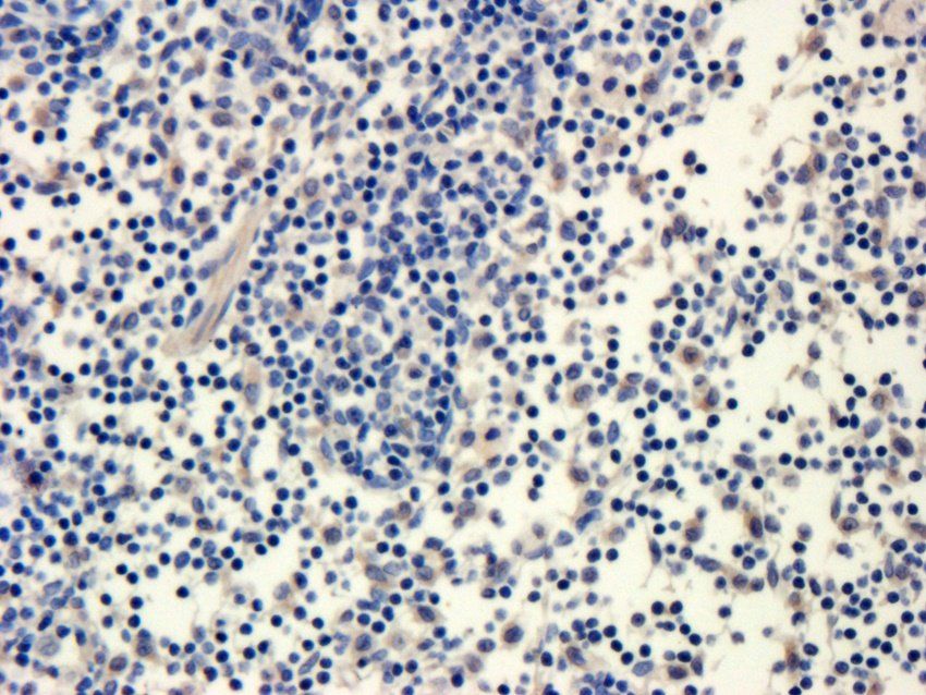 alpha 1 Antitrypsin Mouse Monoclonal Antibody