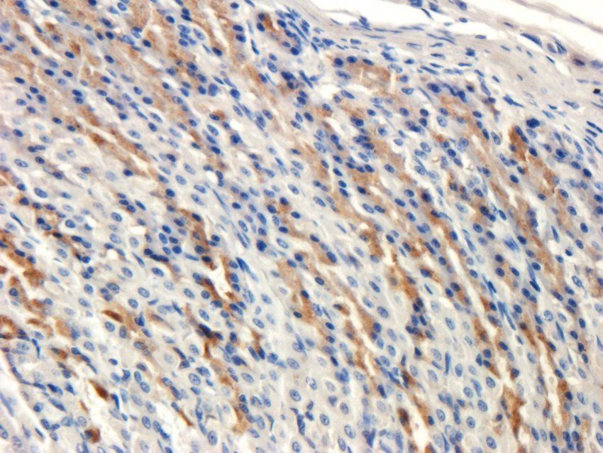 alpha 1 Antitrypsin Mouse Monoclonal Antibody