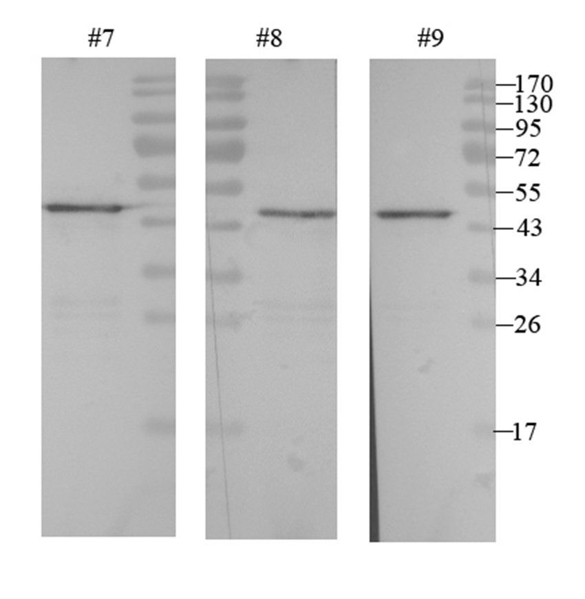 alpha 1 Antitrypsin Mouse Monoclonal Antibody