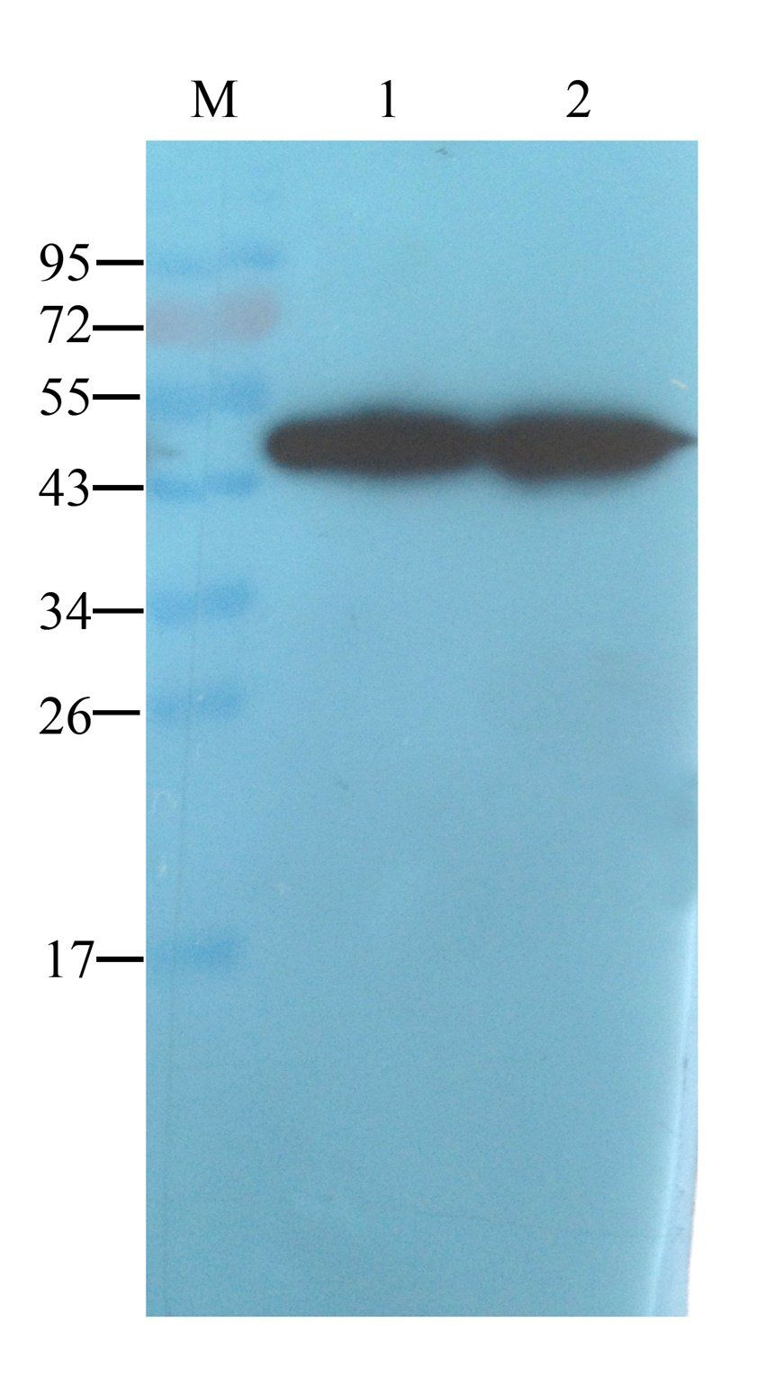 alpha 1 Antitrypsin Mouse Monoclonal Antibody