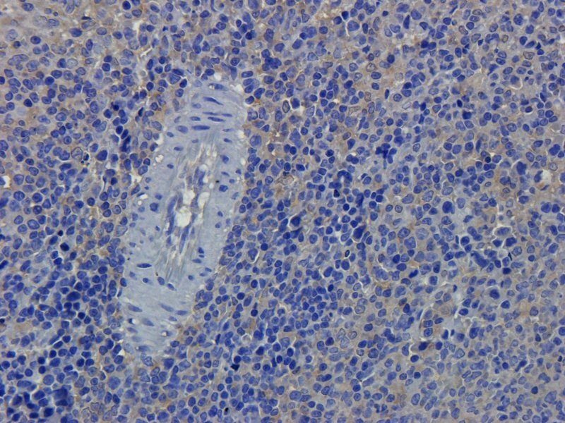 alpha 1 Antitrypsin Rabbit Polyclonal Antibody