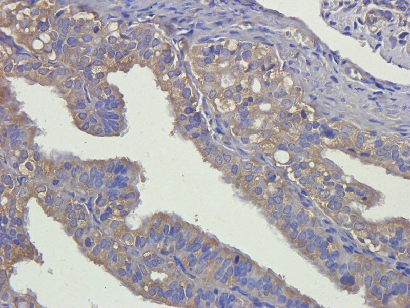 alpha 1 Antitrypsin Rabbit Polyclonal Antibody