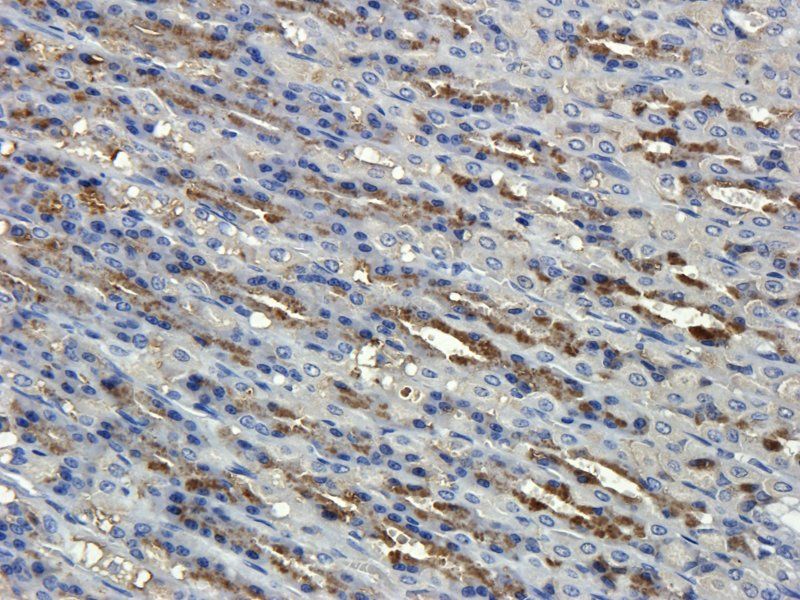 alpha 1 Antitrypsin Rabbit Polyclonal Antibody