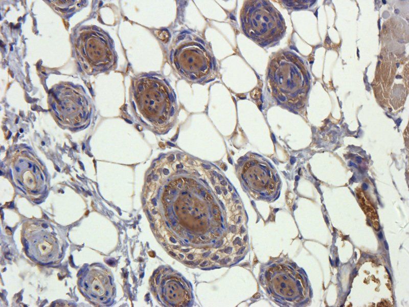 alpha 1 Antitrypsin Rabbit Polyclonal Antibody