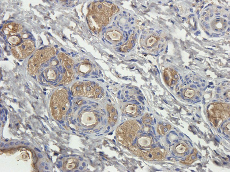 alpha 1 Antitrypsin Rabbit Polyclonal Antibody