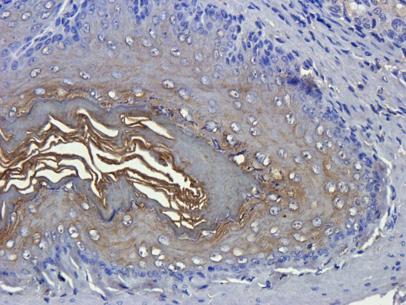 alpha 1 Antitrypsin Rabbit Polyclonal Antibody