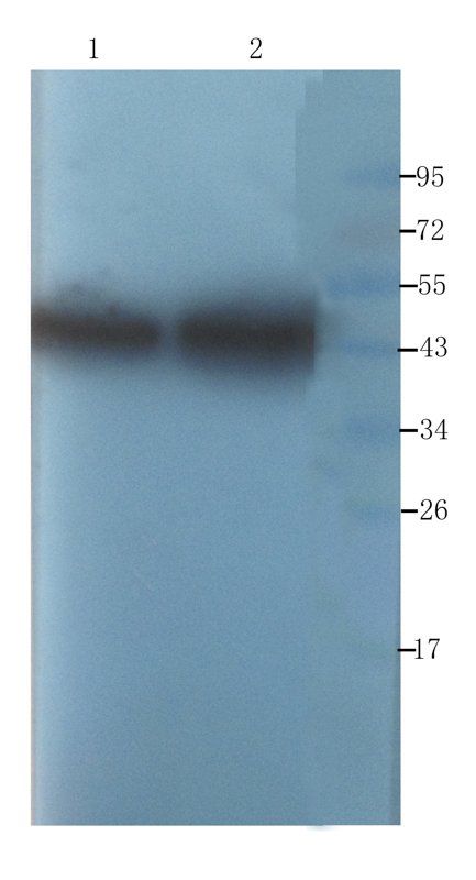 alpha 1 Antitrypsin Rabbit Polyclonal Antibody