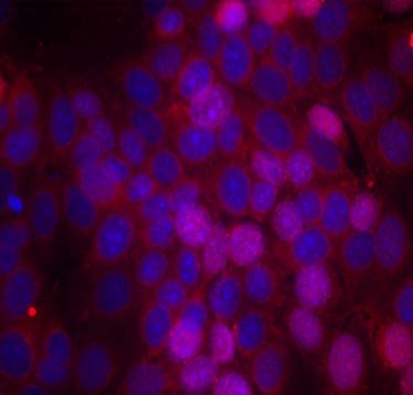 Estrogen Receptor-α (Phospho-Ser106) Antibody