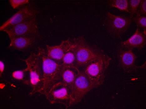 Estrogen Receptor-α (Phospho-Ser118) Antibody