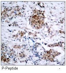 Estrogen Receptor-a(Phospho-Ser167) Antibody