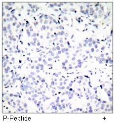 Estrogen Receptor-a(Phospho-Ser167) Antibody