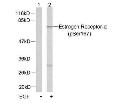 Estrogen Receptor-a(Phospho-Ser167) Antibody