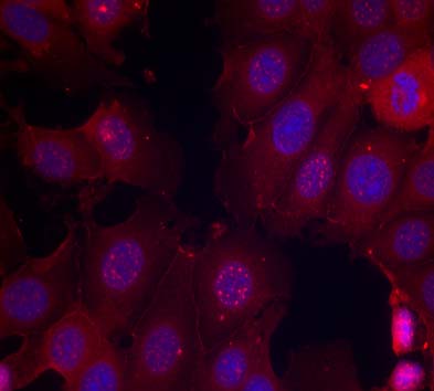 Estrogen Receptor-a(Phospho-Ser167) Antibody