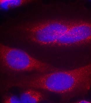 α-Synuclein (Ab33) Antibody