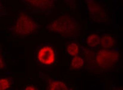 α-Synuclein (Ab36) Antibody