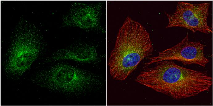 ALPPL2 Rabbit Polyclonal Antibody