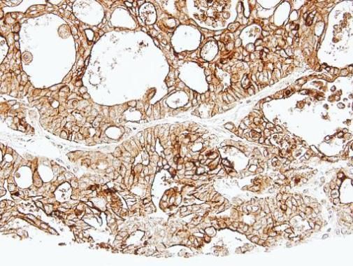 ALPPL2 Rabbit Polyclonal Antibody