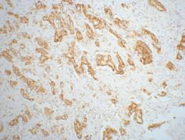 AMACR Antibody