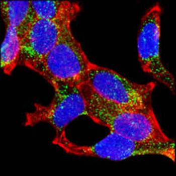 AMACR Antibody