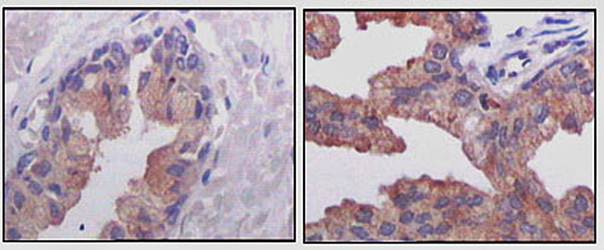 AMACR Antibody