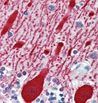AMACR Antibody