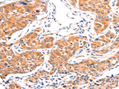 AMPD1 Antibody