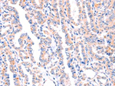 AMPD1 Antibody