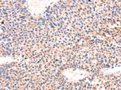 AMPD1 Antibody