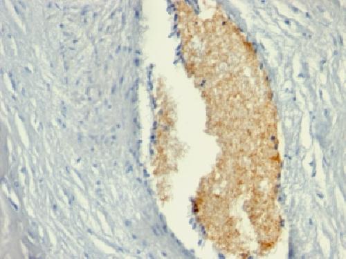 AMPD3 Antibody