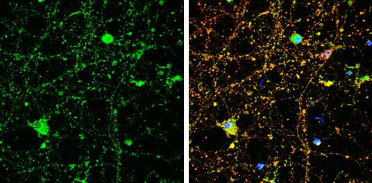 Amphiphysin Rabbit Polyclonal Antibody