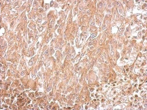 Amphiphysin Rabbit Polyclonal Antibody