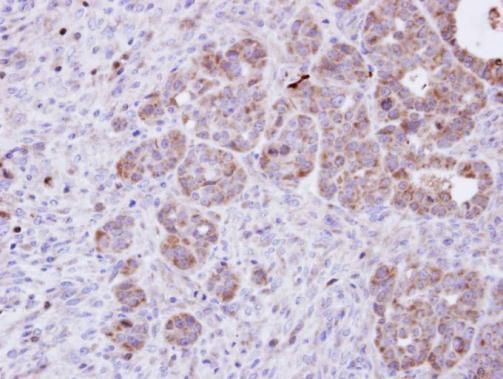 Amphiphysin Rabbit Polyclonal Antibody