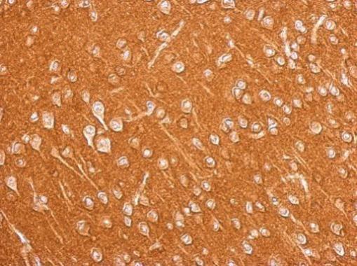 Amphiphysin Rabbit Polyclonal Antibody