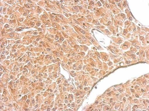 Amphiphysin Rabbit Polyclonal Antibody