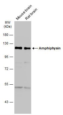 Amphiphysin Rabbit Polyclonal Antibody