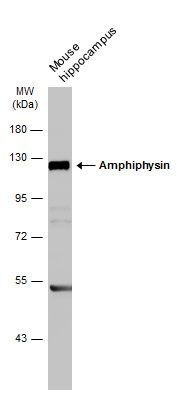 Amphiphysin Rabbit Polyclonal Antibody