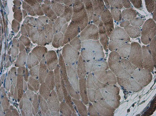 AMPK alpha 2 Rabbit Polyclonal Antibody