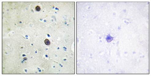 Amyloid β A4 (Phospho-Thr743/668) Antibody